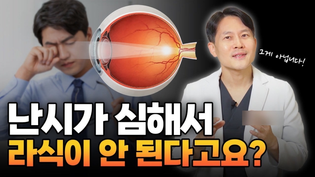 고도난시 정보 영상 사례 - 눈을 비비는 남성과 안구 단면 그림 옆에 '난시가 심해서 라식이 안 된다고요?' 문구를 얹은 안과 유튜브 썸네일